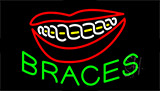 Braces Logo Animated Neon Sign